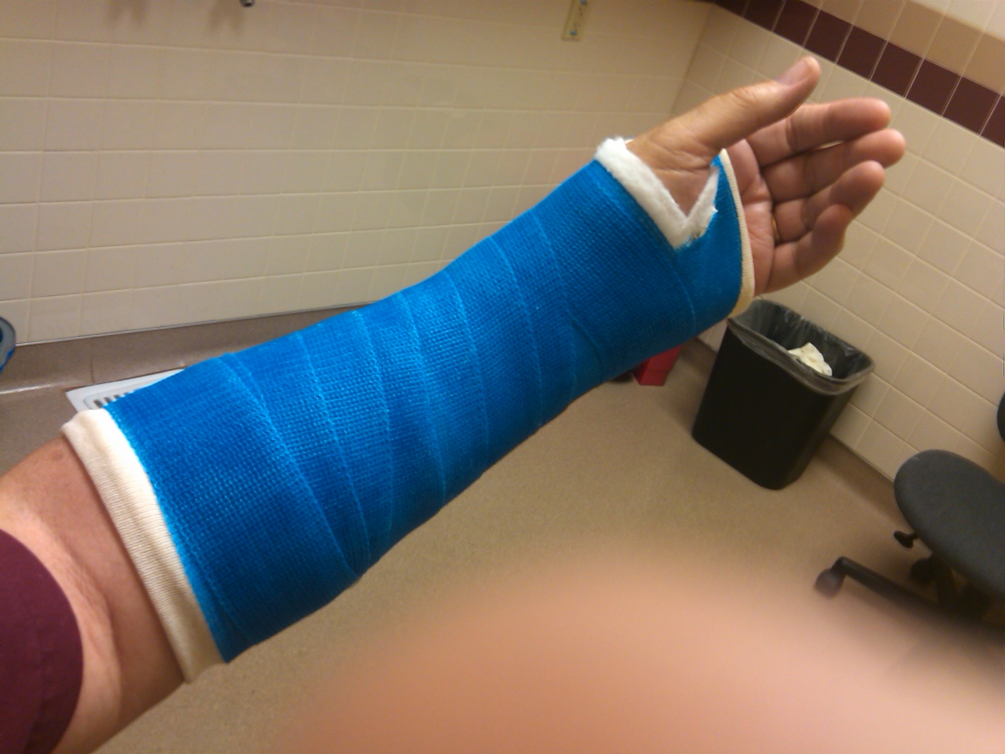 Cast Blue 15